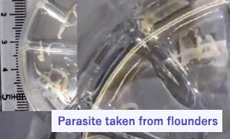 Parasite taken from flounders